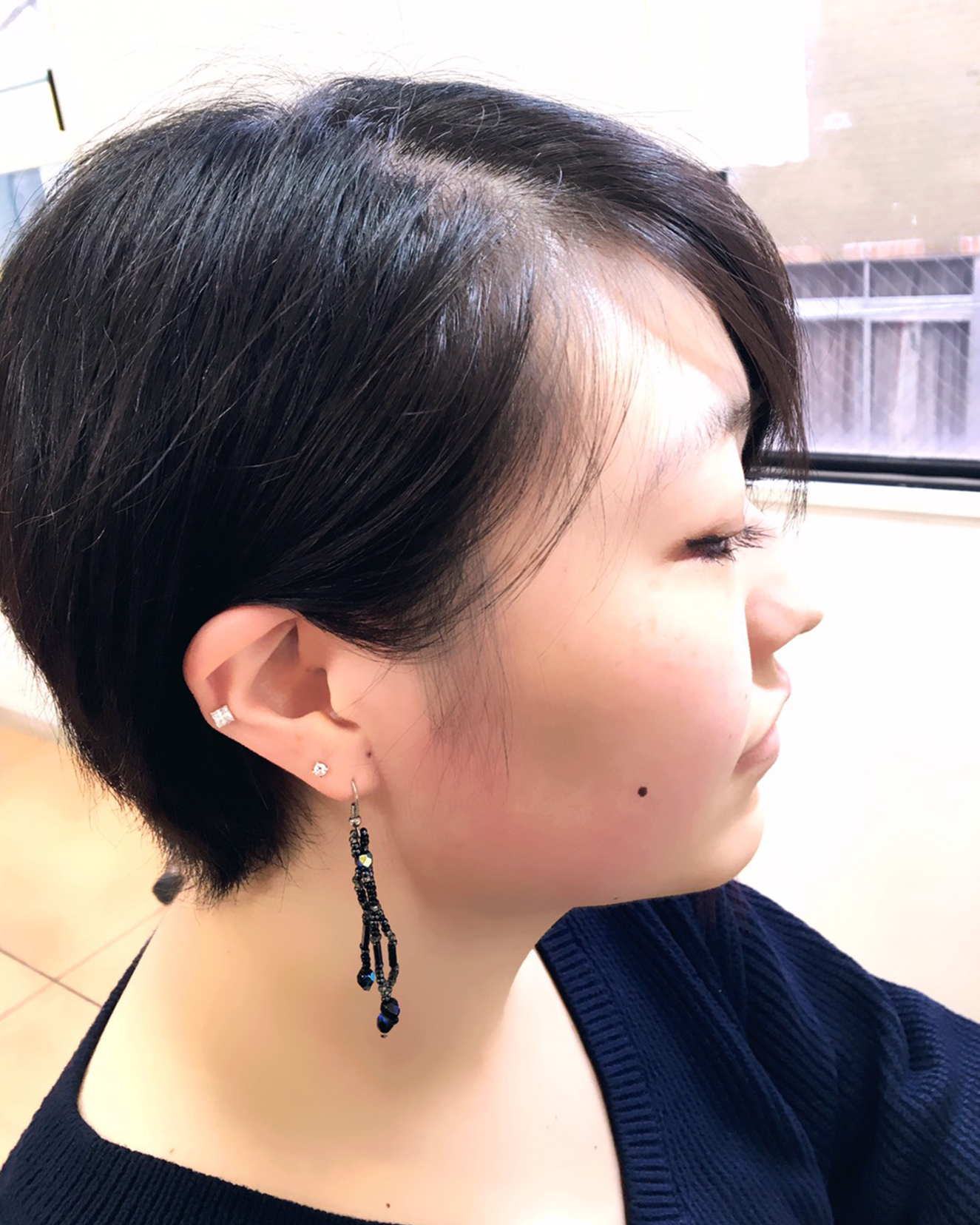 横浜元町ビューティバランス メッシュBefore