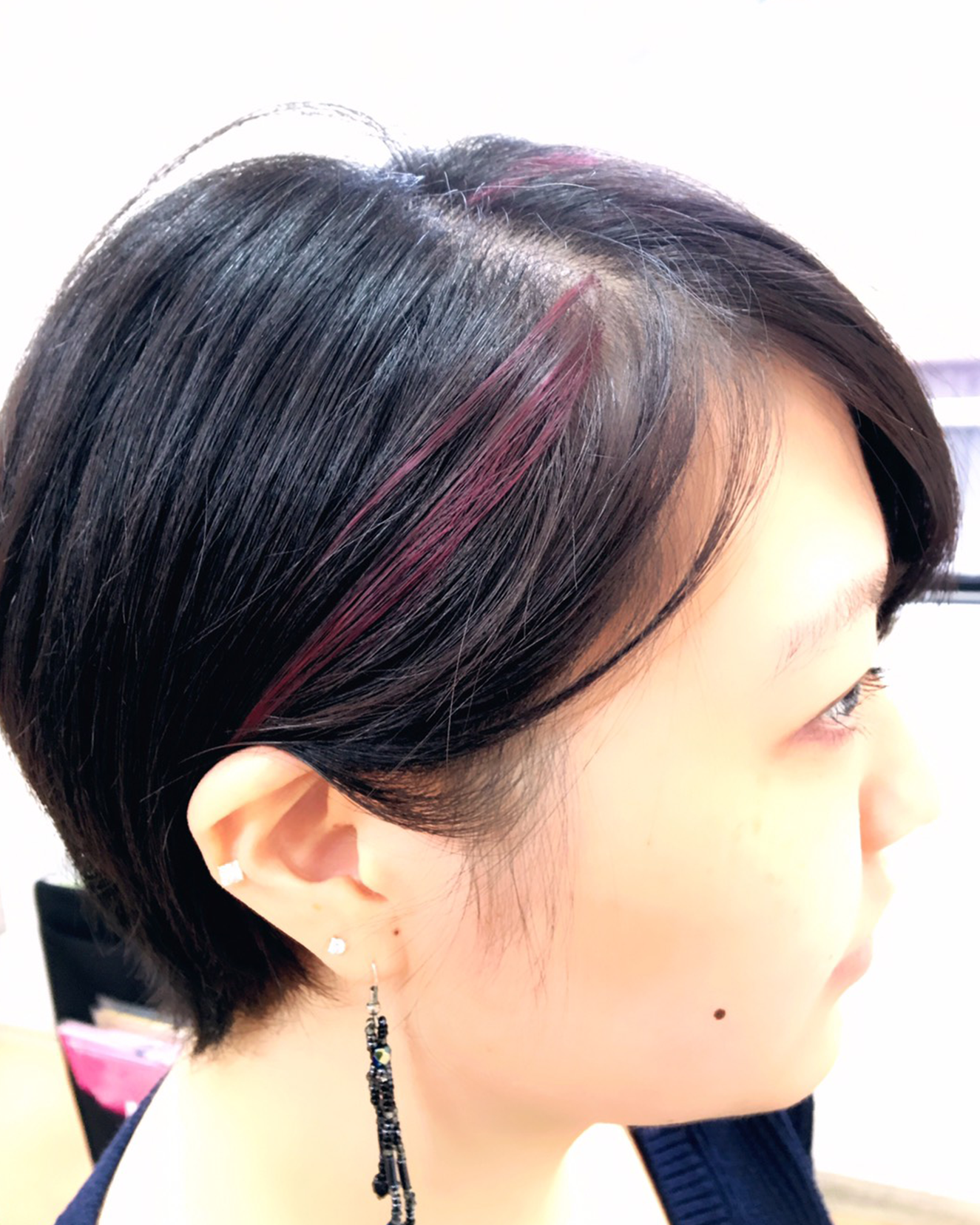 横浜元町ビューティバランス メッシュAfter